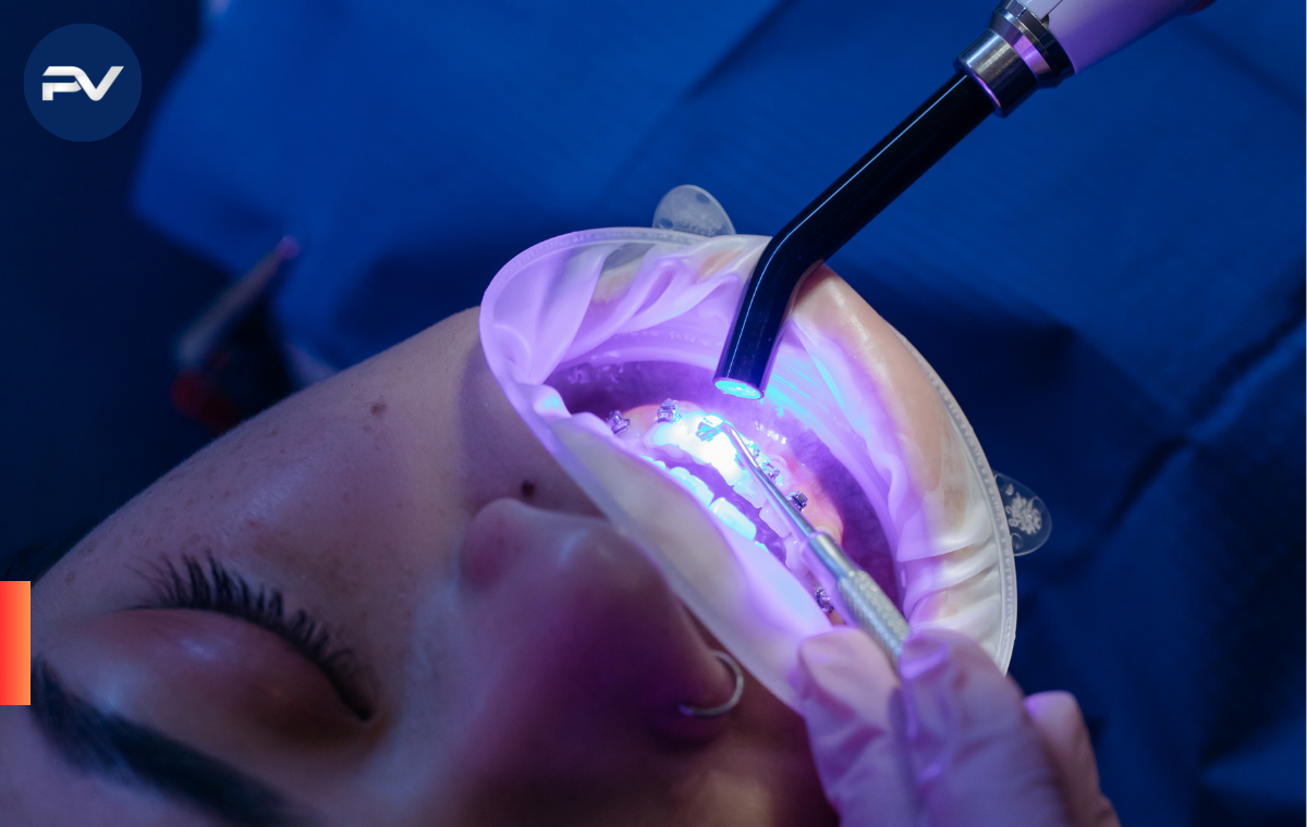 ¿Por qué se forma el sarro en los dientes y cómo evitarlo?
